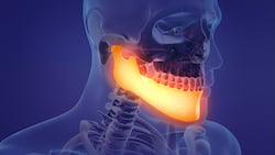 CuraMedix Blog - Animation of a painful mandible