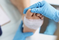 How Shockwave is Revolutionizing Wound Care Treatment