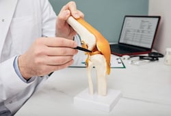 Traumatologist pointing pen to meniscus in a knee-joint anatomical teaching model, close-up - CuraMedix Blog