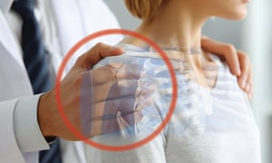 doctor-woman-shoulder-pain