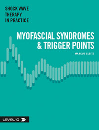 myofascial syndroms